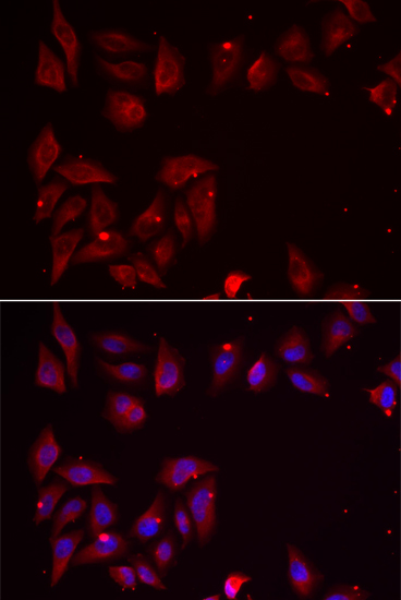 a06683 pdxk primary antiboties if testing 2