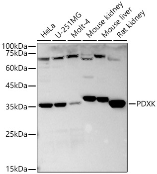 a06683 pdxk primary antiboties wb testing 1
