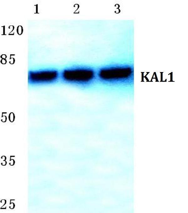 Western blot (WB) analysis of KAL1 polyclonal antibody at 1:500 dilution
Lane1:Jurkat cell lysate
Lane2:Mouse heart tissue lysate
Lane3:Rat heart tissue lysate
