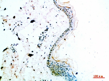 a06685 col14a1 primary antibodyes ihc testing 1
