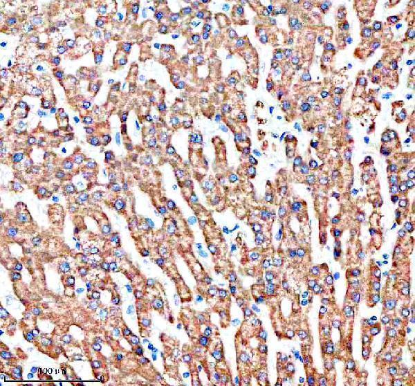  IHC analysis of SHARPIN using anti-SHARPIN antibody (A06687-2)
