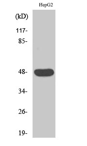 Western Blot analysis of various cells using IGSF4D Polyclonal Antibody
