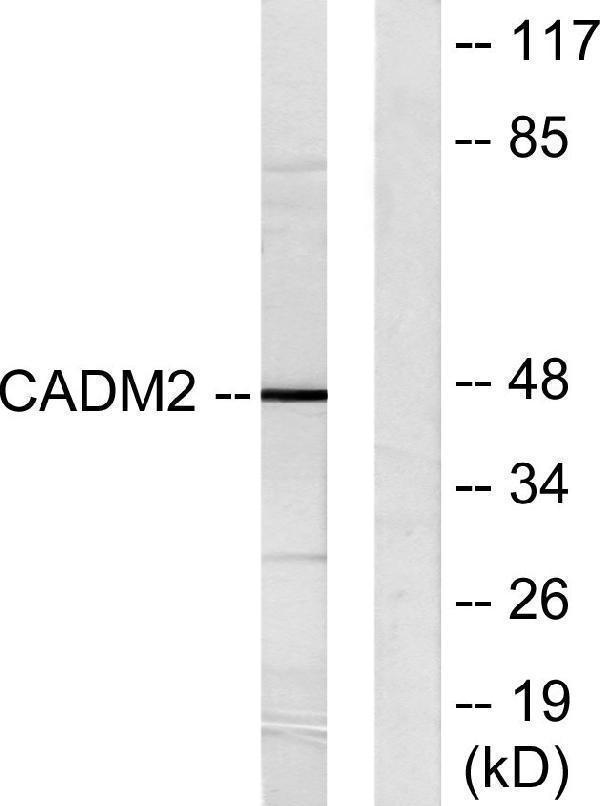 Western blot analysis of lysates from HepG2 cells, using CADM2 Antibody