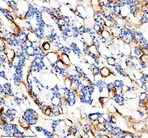  IHC analysis of FYCO1 using anti-FYCO1 antibody (A06691-1)
