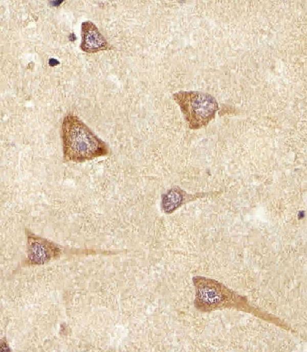 a06692 1 anti ereg antibody c term ihc p testing 6
