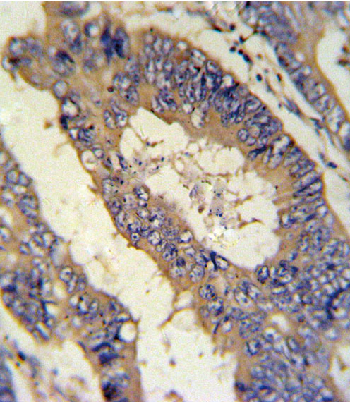 a06692 1 anti ereg antibody c term ihc p testing 7