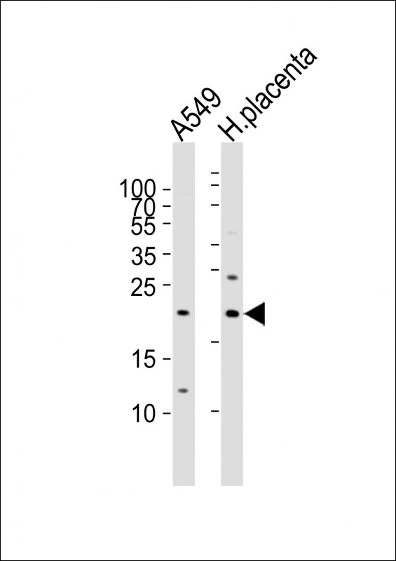 a06692 1 anti ereg antibody c term wb testing 1