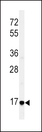 a06692 1 anti ereg antibody c term wb testing 5