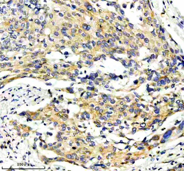 IHC analysis of EREG using anti-EREG antibody (A06692-2)