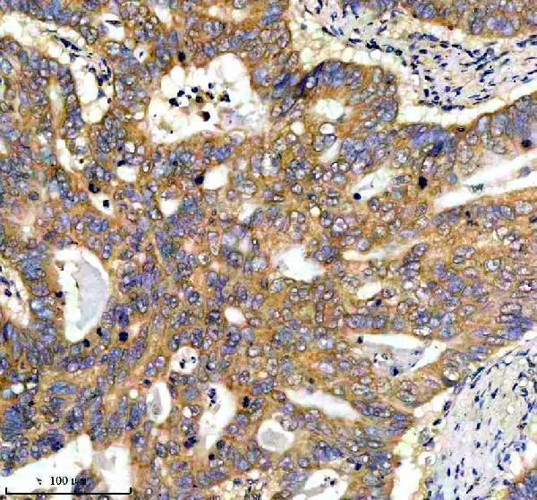IHC analysis of EREG using anti-EREG antibody (A06692-2)