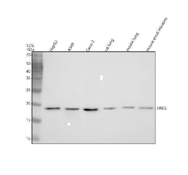 Western blot analysis of EREG using anti-EREG antibody (A06692-2)