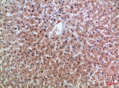 Immunohistochemical analysis of paraffin-embedded Human-liver, antibody was diluted at 1:100