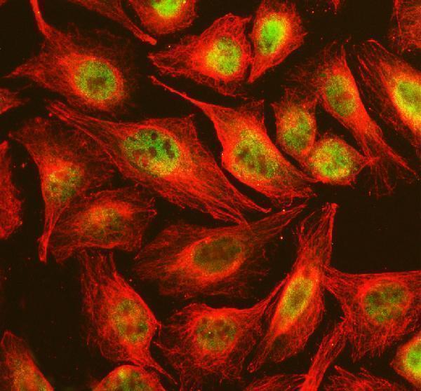  IF analysis of NSMCE2 using anti-NSMCE2 antibody (A06693-1) and anti-Beta Tubulin antibody (M01857-3)