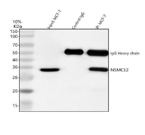  Immunoprecipitating NSMCE2 in MCF-7 whole cell lysate