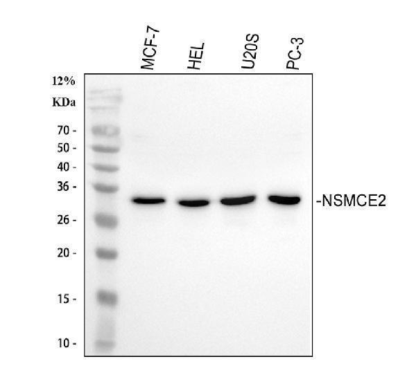  Western blot analysis of NSMCE2 using anti-NSMCE2 antibody (A06693-1)