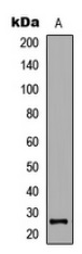 Western blot (WB) analysis of GADD45GIP1 polyclonal antibody at 1:500 dilution 
Line1:Hela whole cell lysate