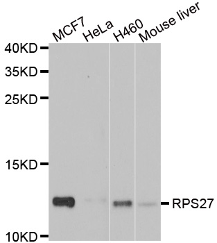 a06699 rps27 primary antiboties wb testing 1