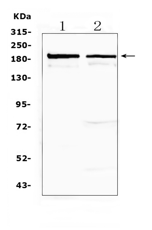  Western blot analysis of Neurocan using anti-Neurocan antibody (A06700-1)