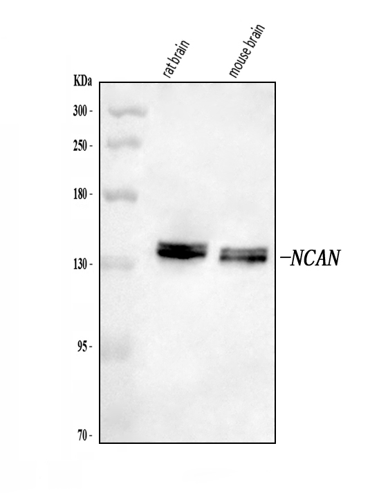  Western blot analysis of Neurocan/NCAN using anti-Neurocan/NCAN antibody (A06700-2)