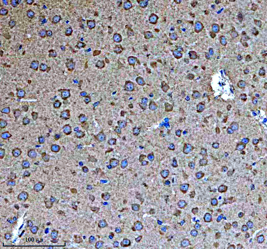 IHC analysis of RPL26 using anti-RPL26 antibody (A06701-2)