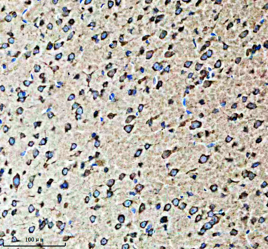 IHC analysis of RPL26 using anti-RPL26 antibody (A06701-2)