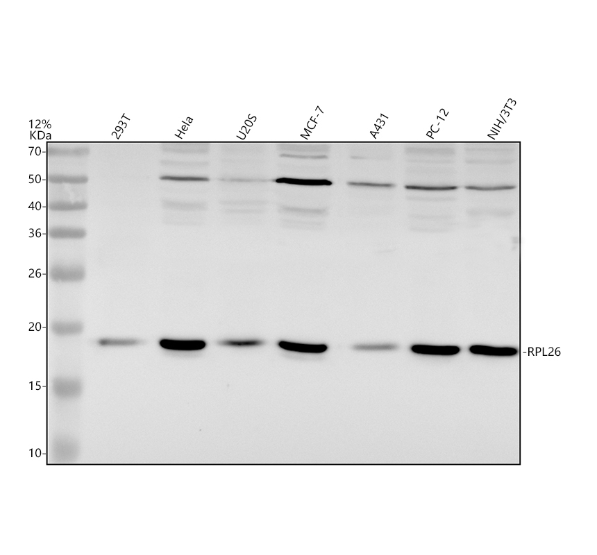 Western blot analysis of RPL26 using anti-RPL26 antibody (A06701-2)