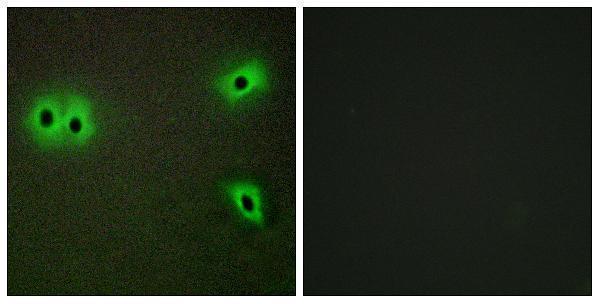 a06702 col13a1 primary antibodies if testing 1