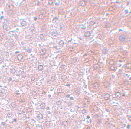 a06703 anapc4 primary antibodies ihc testing 2