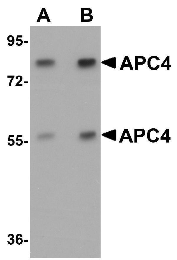 a06703 anapc4 primary antibodies wb testing 1