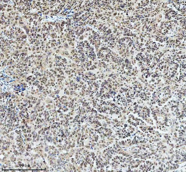  IHC analysis of RAD51AP1 using anti-RAD51AP1 antibody (A06705-2)