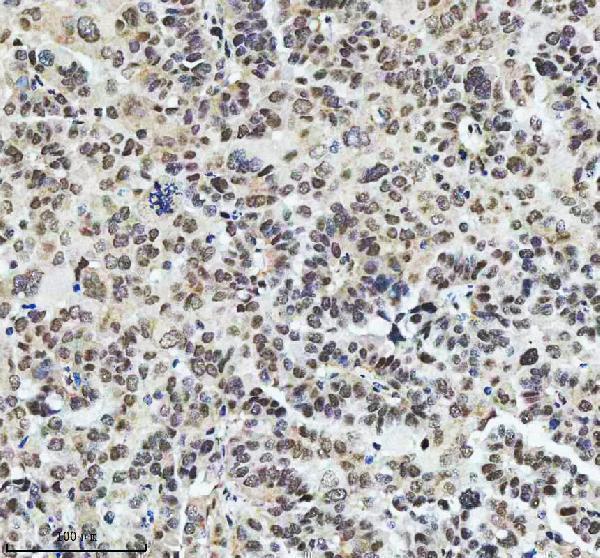  IHC analysis of RAD51AP1 using anti-RAD51AP1 antibody (A06705-2)