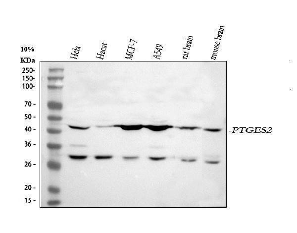  Western blot analysis of PTGES2/Gbf1 using anti-PTGES2/Gbf1 antibody (A06706-2)