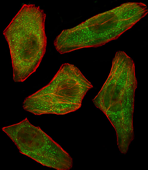 a06707 1 anti pik3r3 antibody c term if testing 1