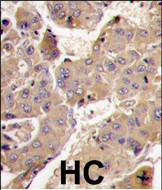 a06707 1 anti pik3r3 antibody c term ihc p testing 3