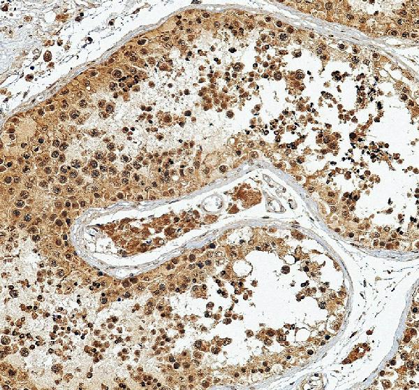 IHC analysis of RFX2 using anti-RFX2 antibody (A06709-1)
