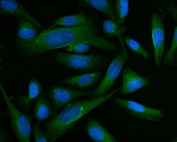 a06712 2 bhmt primary antibodies if testing 10