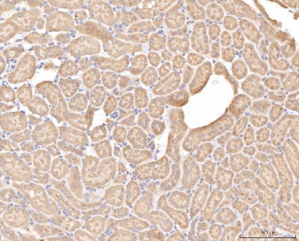 a06712 2 bhmt primary antibodies ihc testing 7