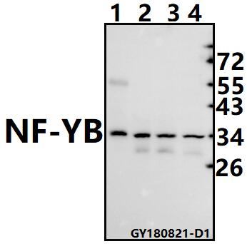 Western blot (WB) analysis of NF-YB (Q30)  pAb at 1:500 dilution
Lane1:The Brain tissue lysate of Rat(40ug)
Lane2:SGC7901 whole cell lysate(40ug)
Lane3:A375 whole cell lysate(40ug)
Lane4:Panc1 whole cell lysate(40ug)