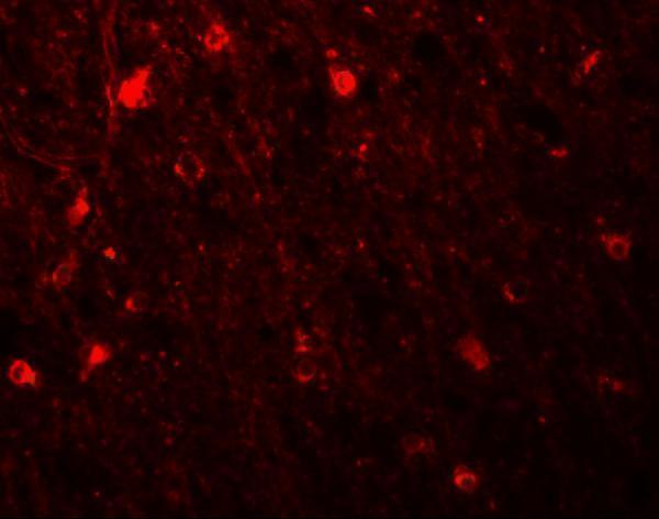 a06716 sipa1l1 primary antibodies if testing 3