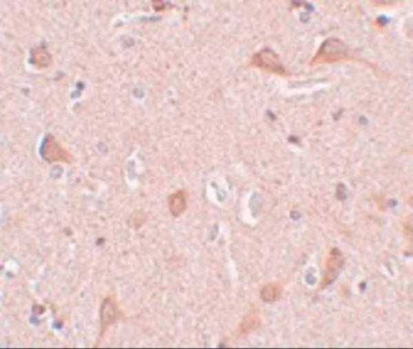 a06716 sipa1l1 primary antibodies ihc testing 2