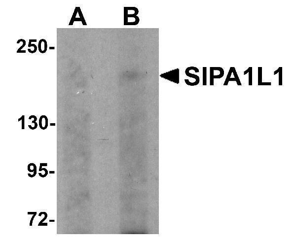 a06716 sipa1l1 primary antibodies wb testing 1