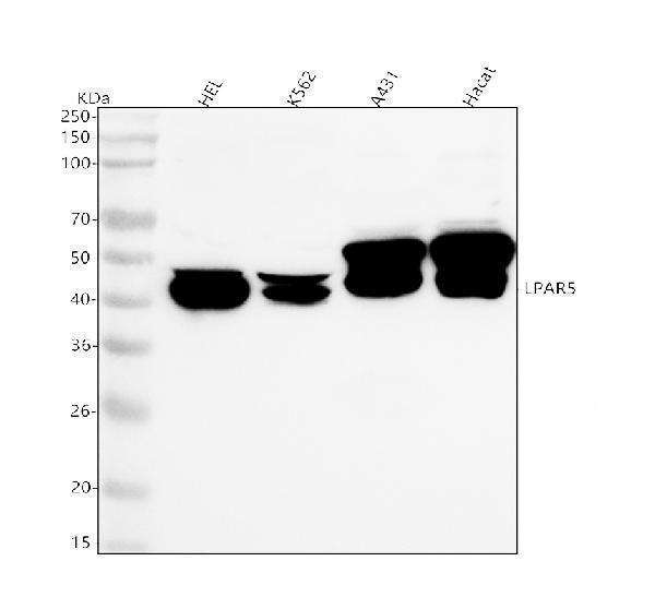  Western blot analysis of GPR92/LPAR5 using anti-GPR92/LPAR5 antibody (A06721-1)
