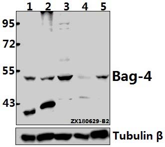 a06722 2 bag4 primary antiboties wb testing 1