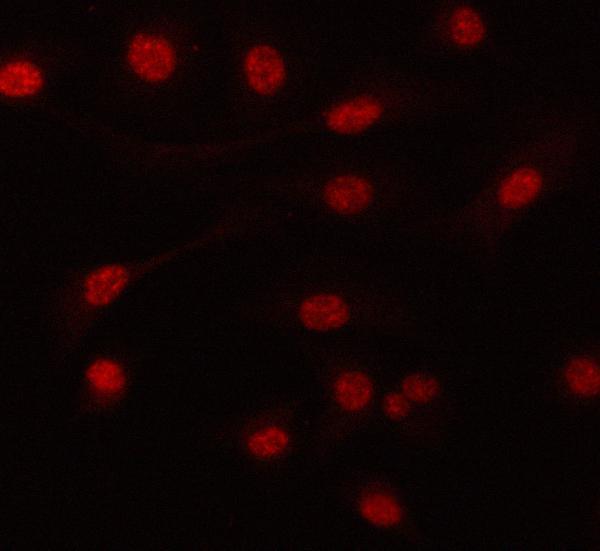  IF analysis of PRPF6 using anti-PRPF6 antibody (A06724-2)