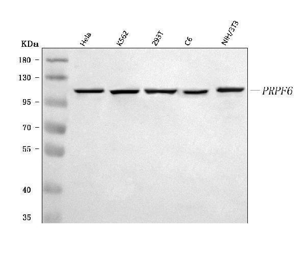  Western blot analysis of PRPF6 using anti-PRPF6 antibody (A06724-2)