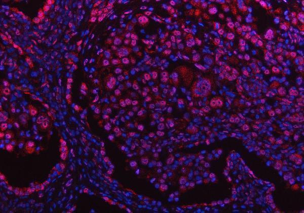 a06725 2 ppm1g primary antibodies if testing 10