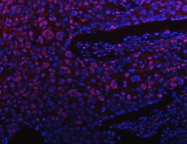 a06725 2 ppm1g primary antibodies if testing 11