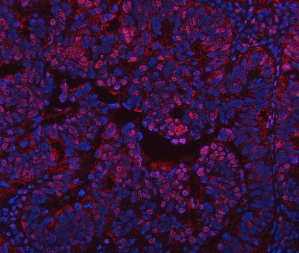 a06725 2 ppm1g primary antibodies if testing 12