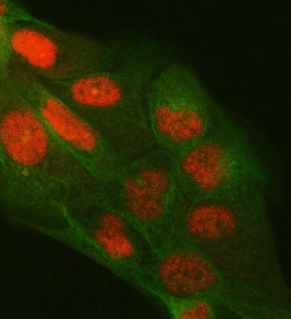 a06725 2 ppm1g primary antibodies if testing 8