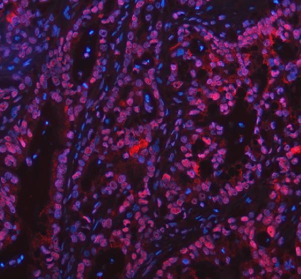 a06725 2 ppm1g primary antibodies if testing 9